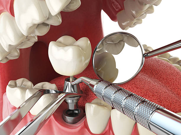 Best Emergency Gum Treatment in Winchester, MO